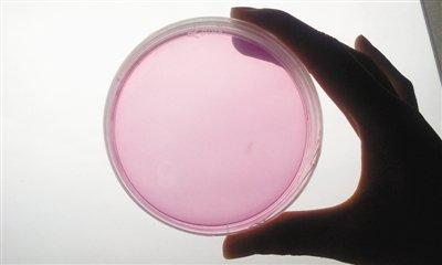 经验分享|实验室霉菌检测中常见问题