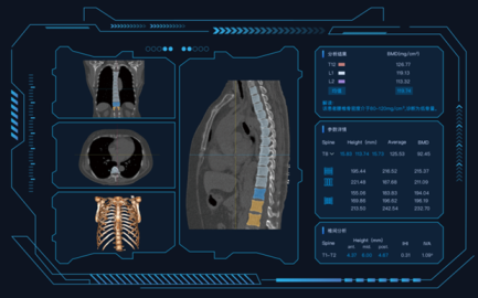 骨密度计算机辅助检测软件-临床评价路径推荐